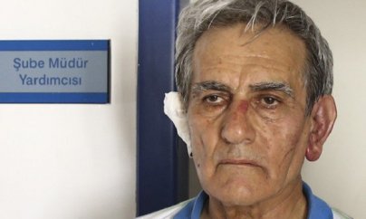 Türkiyədə generalın qulağını kəsdilər