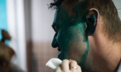 Navalnıya hücum olub, bir gözü zədələnib