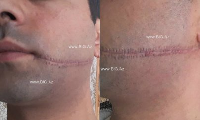 ''Oğlumun ağzını bıçaqla kəsən cəzasız qalıb''