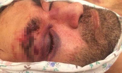 Prokurorluq polisə çağırılan şəxsin öldürüldüyünü təsdiqlədi