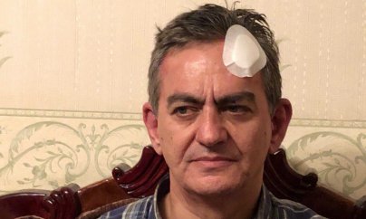 Baş Prokurorluq Əli Kərimli ilə bağlı açıqlama yaydı