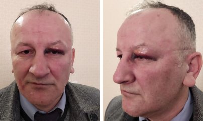 Polis maşınının içində 3 nəfər üzümə yumruq-təpik vurub - Mustafa Hacıbəyli