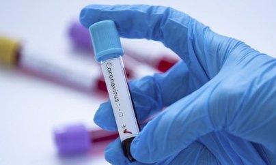 İrandan qayıdan daha üç azərbaycanlıda koronavirus aşkarlandı