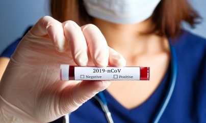 Azərbaycanda daha 78 nəfərdə koronavirus aşkarlandı