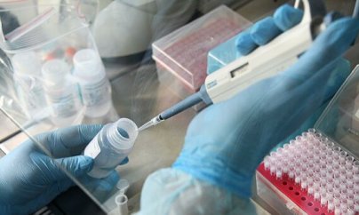 Azərbaycanda daha 105 nəfərdə koronavirus aşkarlandı