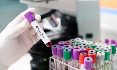 Daha 104 nəfərdə koronavirus aşkarlanıb, 1 nəfər ölüb