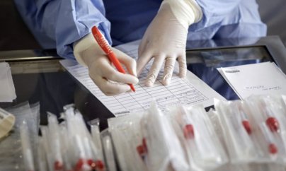 Azərbaycanda daha 56 nəfər koronavirusa yoluxub