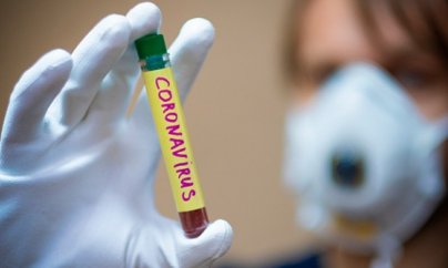 Azərbaycanda daha 38 nəfər koronavirusa yoluxub