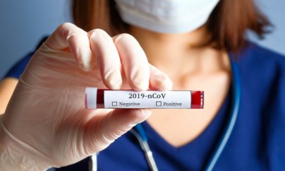 Azərbaycanda daha 44 nəfər koronavirusa yoluxub