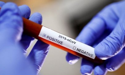 Azərbaycanda daha 50 nəfərdə koronavirus aşkarlandı