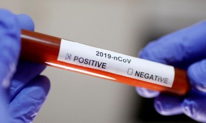 Azərbaycanda 33 məhkumda koronavirus aşkarlanıb