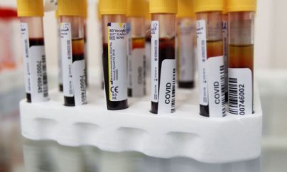 106 nəfər koronavirusa yoluxub, 2 nəfər ölüb