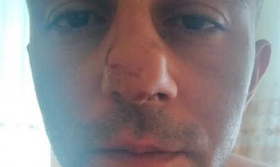 Aprel döyüşçüsü: Polislər məni huşumu itirənədək döydülər