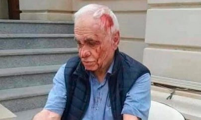 Rəhim Qazıyev başından xəsarət alıb