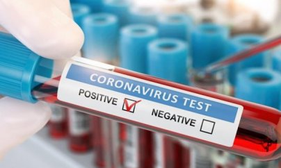 Azərbaycanda bir gündə koronavirus statistikası: 517 yoluxma, 7 ölü