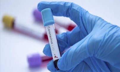 Koronavirus: 544 yoluxma, 8 ölü