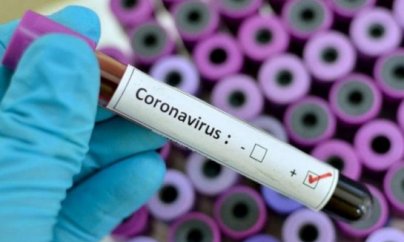 Azərbaycanda koronavirus: 526 yoluxma, 502 nəfər sağalıb