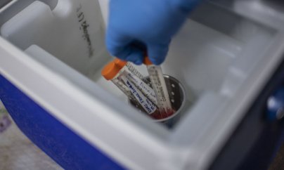 Agentlik koronavirus testi ilə bağlı məlumat yaydı: “Üzr istəyirik, səhv olub..!”