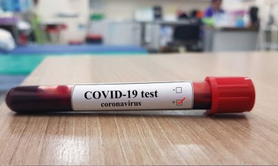 Azərbaycanda koronavirusa yoluxanların sayı bu gün də artdı