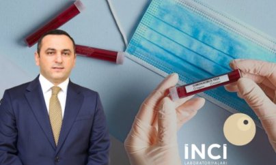 Koronavirus testləri TƏBİB-in monopoliyasındakı klinikalardan çıxarılır?