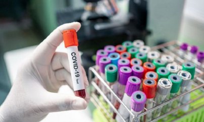 Azərbaycanda koronavirus: 119 yoluxma, 140 sağalma, 2 ölü
