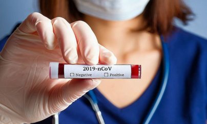 Koronavirusa 1395 yeni yoluxma