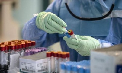 Azərbaycanda koronavirusa yoluxanların sayı 3700-ü keçdi