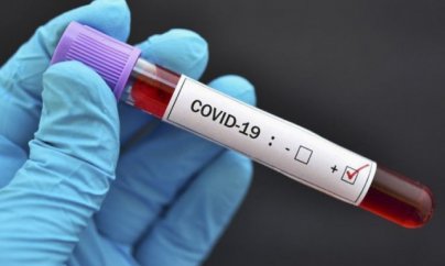 Çinin koronavirus peyvəndi Türkiyəyə gətirildi