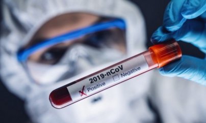 Azərbaycanda koronavirus: 803 yeni yoluxma