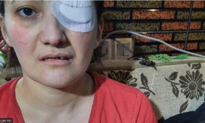 Müharibədə zərərçəkmiş Gəncə sakini: 