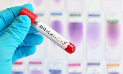 Azərbaycanda koronavirusa yoluxanların sayı yenidən 600-ü ötüb