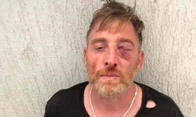 Tbilisidə döyülən telekanal əməkdaşı ölüb