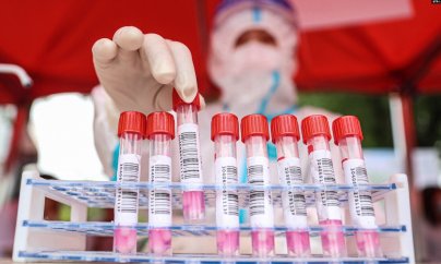 Kəşfiyyat virusun mənşəyi üzrə bir qənaətə gələ bilməyib