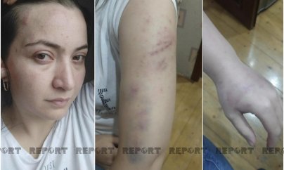 Polisin öldürdüyü qadının qardaşı: 