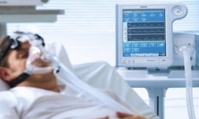 Bakıda 1 milyonluq aparat koronavirus xəstələrinə kirayə verilir - Yoluxanların 10 min xərci var