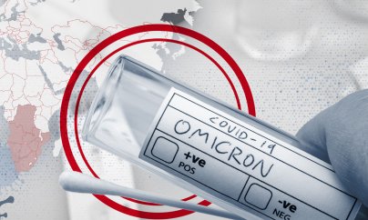 Azərbaycanda 53 nəfər “Omicron”dan dünyasını dəyişib