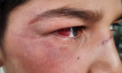 “Polis poqonuna güvənib, uşağı təpiyinin altına salıb, döyüb”