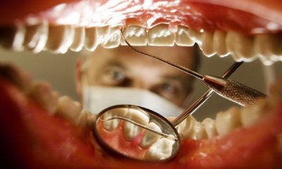 “Çənəmi sındırandan sonra bilmişəm ki, dişimi çəkən stomatoloq deyilmiş”