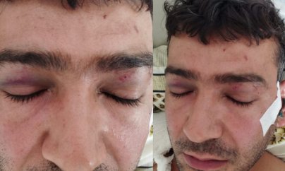 “Polislər məni ömürlük şikəstə çevirdi”