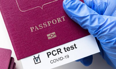 Azərbaycanda COVID-19 pasportu ləğv edildi