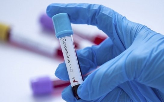 İrandan qayıdan daha üç azərbaycanlıda koronavirus aşkarlandı