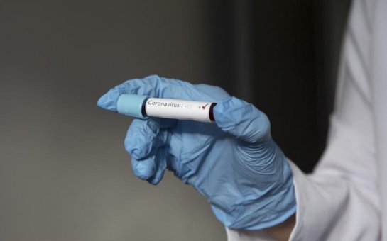 Azərbaycanda daha 4 nəfərdə koronavirus aşkarlandı