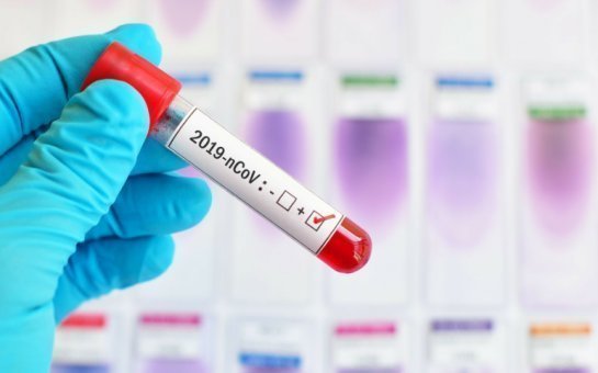 Azərbaycanda daha 65 nəfər koronavirusa yoluxdu: ölən var