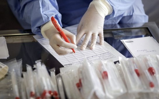 Azərbaycanda daha 56 nəfər koronavirusa yoluxub