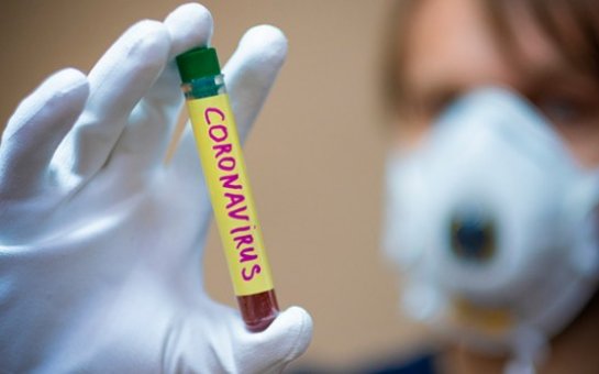 Azərbaycanda daha 38 nəfər koronavirusa yoluxub