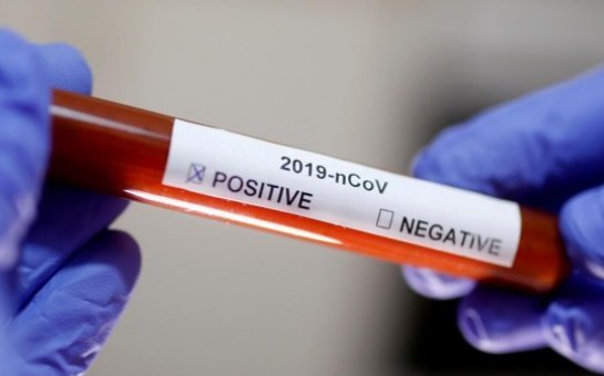 Rusiyada koronavirusa yoluxanların sayı 80 mini keçdi