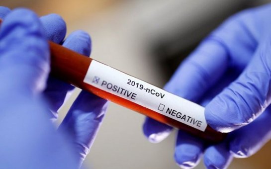 Azərbaycanda daha 50 nəfərdə koronavirus aşkarlandı