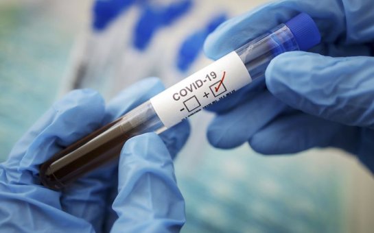 İranda son sutkada koronavirusdan 64 nəfər vəfat edib