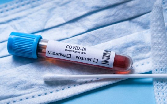 Azərbaycanda daha 248 nəfər koronavirusa yoluxdu, 2 nəfər öldü