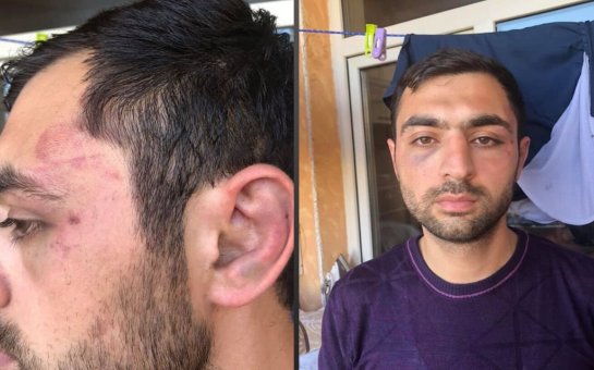 Gülər Süleymanova: Oğlumu 30 nəfər 5 saat döyüb, indi deyirlər, polisi bağışla